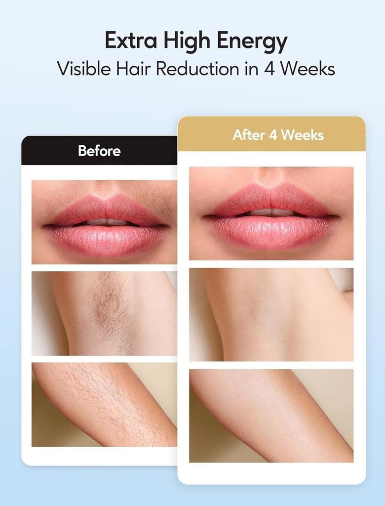 999999 Flashes Laser Hair Removal Device with Ice Cooling Care Function for Women Painless Whole Body Permanent Hair Removal