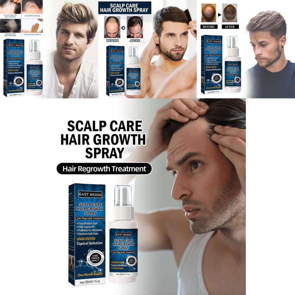 East Moon Men's Hair Growth Spray For Thicker Hairline And Prevents Hair Loss