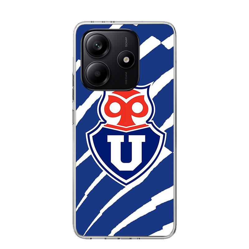 De Chile U-University Logo Phone Case For Xiaomi Redmi Note 15 14 13 12S 12 Pro Plus 11S 11E 11 11T 10S 10 Art Soft Pattern Cove