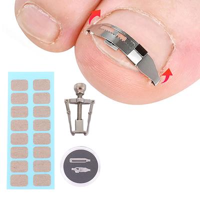 Herramientas correctoras para uñas encarnadas, pedicura, recuperación, incrustación, tratamiento para uñas de los pies, cuidado profesional de los pies, herramienta de corrección, cuidado de los pies