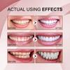 Dentifrice probiotique SP-10 Blanchiment des dents Élimine la plaque dentaire Taches Blanchiment des dents Hygiène bucco-dentaire Propre Haleine fraîche Produit de soin des dents