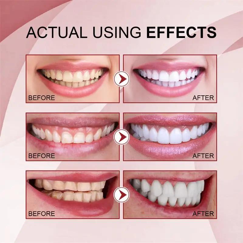 Dentifrice probiotique SP-10 Blanchiment des dents Élimine la plaque dentaire Taches Blanchiment des dents Hygiène bucco-dentaire Propre Haleine fraîche Produit de soin des dents