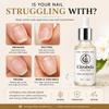 Citrabela Nail & Cuticle Serum with Jojoba Oil, Nourishing & Strengthening Care for Nails and Cuticles, For Dry, Rough & Brittle Looking Nails, 30 Ml