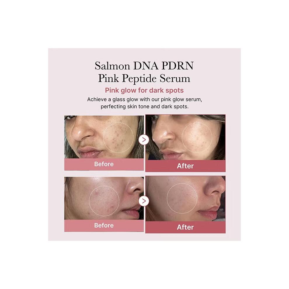 Medicube PDRN Pink Peptide Serum 30ml | Pink Glow Serum, Peptide, Niacinamide, Hydrating, Moisturizing & Firming, Uneven Skin Tone, Korean Skincare