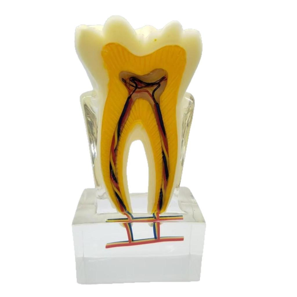 Dental Nerve Model - Tooth Structure Display, Cross-section Analysis, 6x Magnification for Oral Teaching
