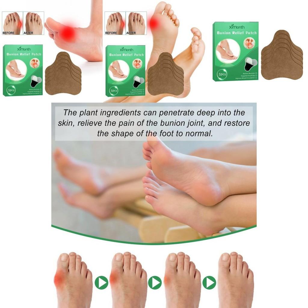 Ximonth Premium Soft Gel Pads For Gentle Relief Of Foot Pain And Discomfort