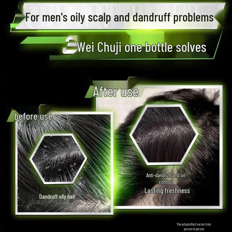 Clear Men Anti-Dandruff Shampoo