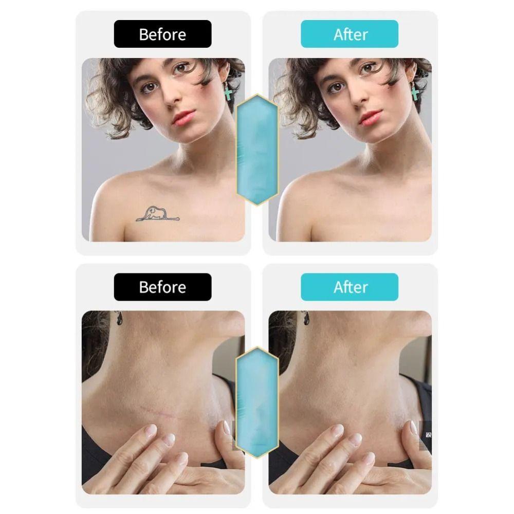 8Pcs Temporary Birthmark Concealing Sticker Skin Color Scar Concealer Sticker  Black Spot