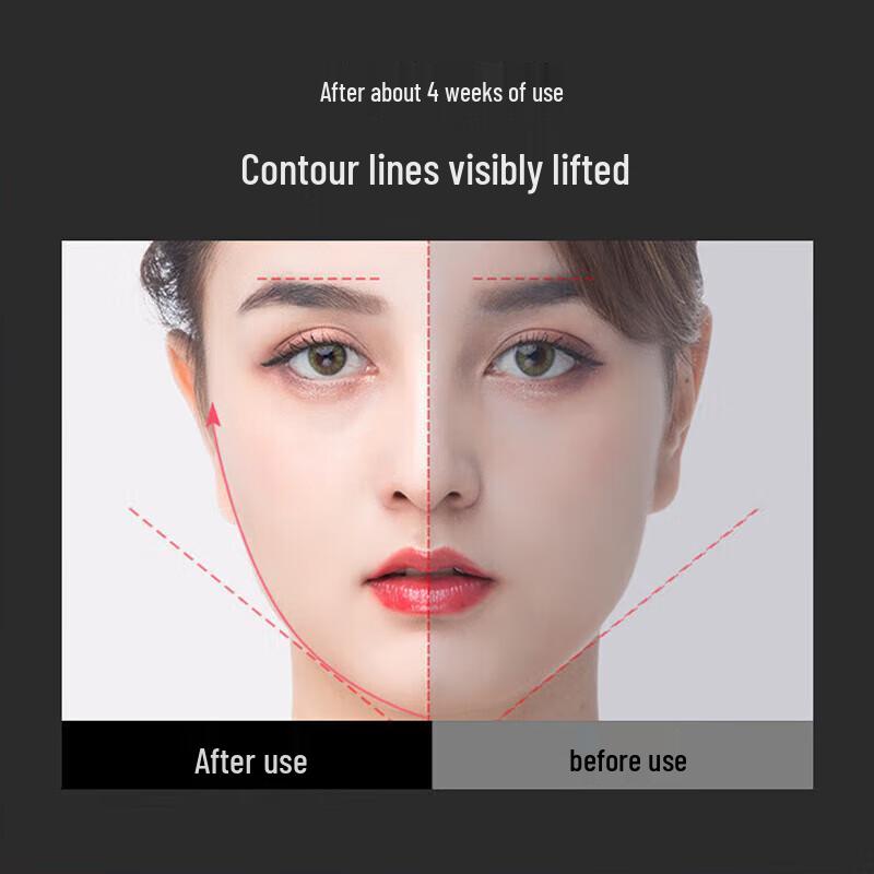 KinGdom Ultrasonic Facial Massager