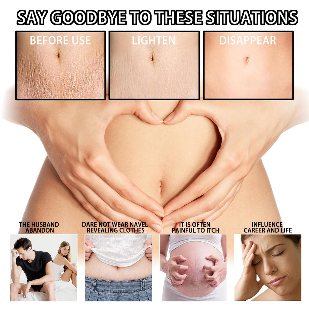 Hautpflegecreme Sanfte Pflege Glättende Haut Straffende Bauchmassage Postpartale Hautpflegecreme