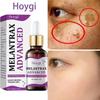 Siero Viso OggiGi Niacinamide Vitamina B3 Anti-Rughe Schiarente Macchie Idratazione 30ml