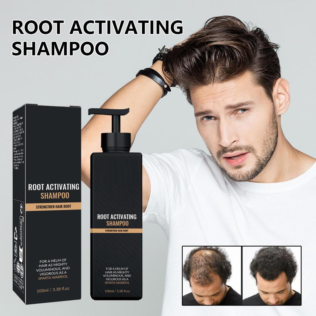 Hair Loss Treatment Shampoo Promotes Growth, Strengthens Roots, Repairs Scalp, Anti-Thinning