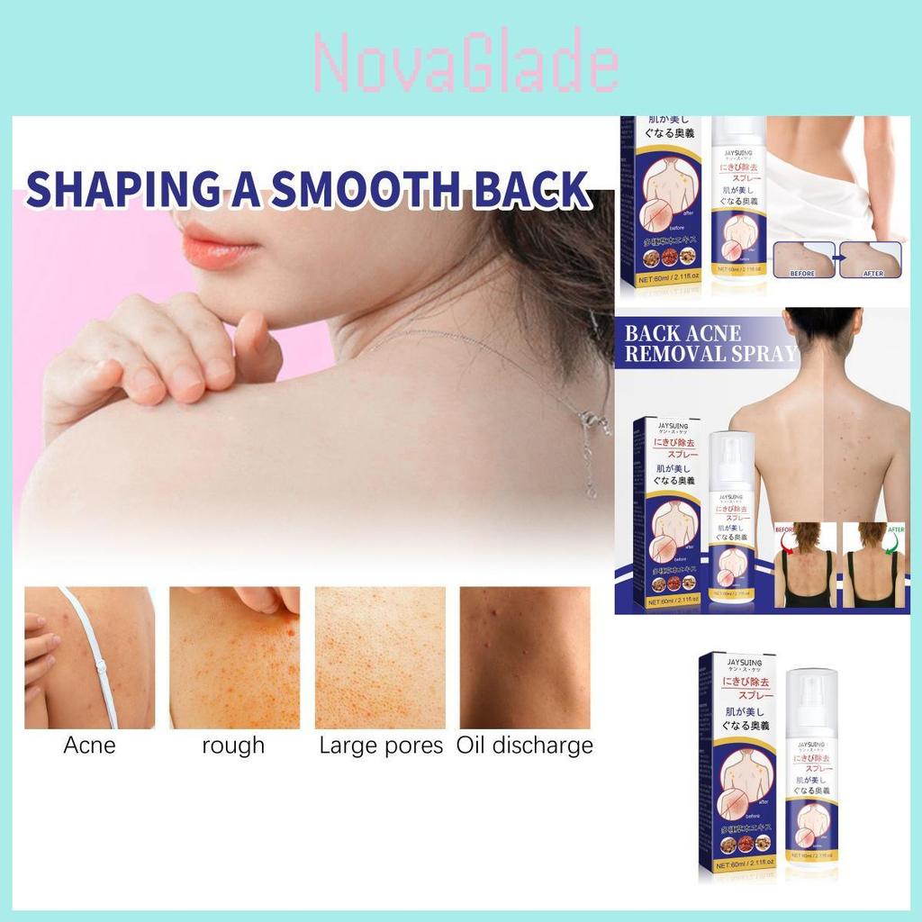 Jaysuing Back Care Spray For Fading Acne Marks And Smoothing Skin Texture