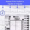 Electrocardiogram Assessment Tool 7 Step Ruler Card For Hospitals Clinics Healthcare Professional And Medicals Students