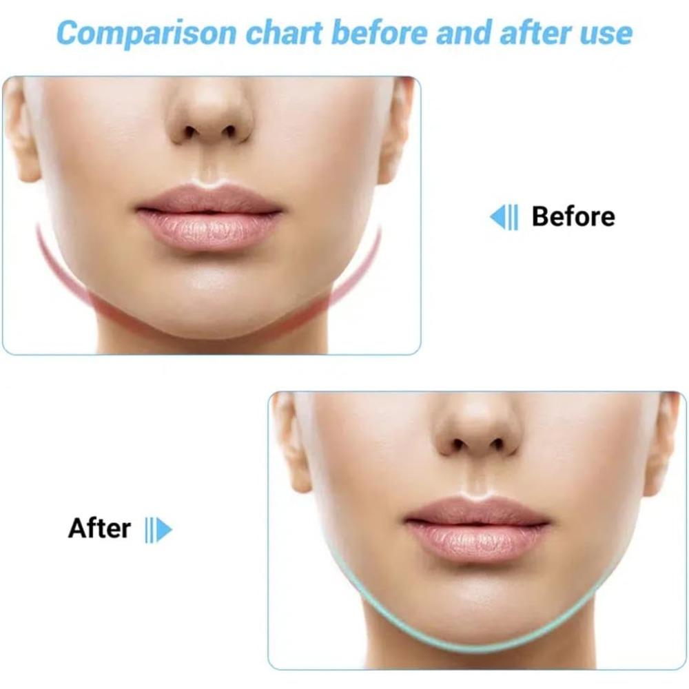 Electric V-Shaped Massager - Face Firming Machine Beauty Device Double Chin Removal Machine