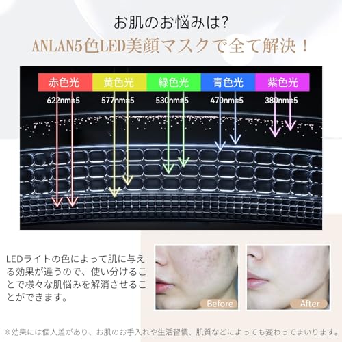 ANLAN LED Facial Beauty Mask, Facial Beauty Device, Illuminated Beauty Treatment, 5-Color LED Light, Heating Mask, Facial Heating Care, IPX5 Waterproo