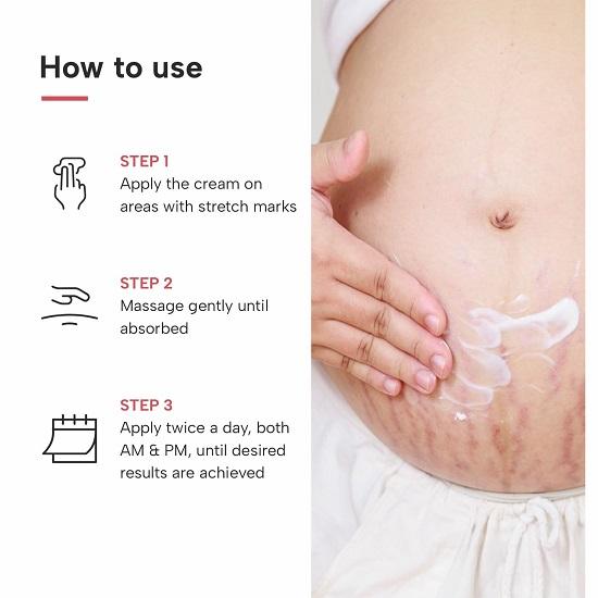 Dermatouch Bye Bye Stretch Mark Cream for Pregnancy to Reduce Stretch 125gm