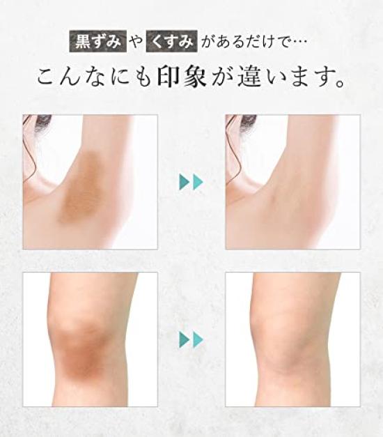 N1us Medicated Whitening for Dark Made In Highly for Whole Body Use and Sensitive Areas Cream, 46g, Spots, Japan, Moisturizing,