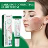 Whitening Freckle Serum Fade Pigmentation Moisturizing Brightening Improve Dull Anti Aging Remove Dark Spots Face Care Essence