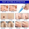 Skin Tag Remover kit,Appareil Pour Enlever Acrochordon Petit, Moyen,Grand Sans Cicatrice Indolore Kit D'élimination Des Acrochordons