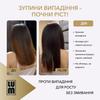 LUM kit "90-day course: follicle activation and density formation"