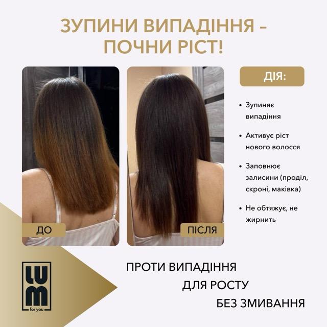 LUM kit "90-day course: follicle activation and density formation"