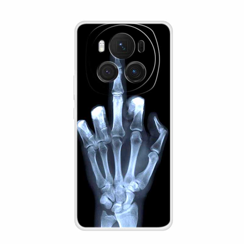 Case For Huawei Honor Magic 6 Pro Soft Silicone Transparent Phone Protective Cover For Honor Magic6 Lite 5G Bumper Magic6 5G Honor Magic6 Pro