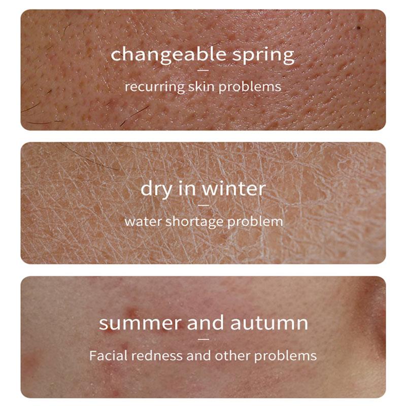 Schnecken-Gesichtscreme, feuchtigkeitsspendende und verjüngende Gesichtspflegeprodukte