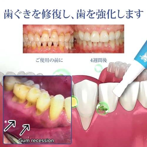 Gum Care Gel, Glossy Whitening Toothpaste Gel, Periodontal Pro Care, Interdental Gel, Gum Therapy Gel for Recessed Gums, Repairs and Protects Gum Tiss