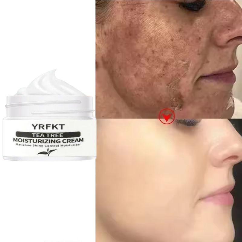 Tea Tree Moisturizing Serum Cream Anti-Acne Shrink Pores Face Cream Oil Control Hydrate Smooth Repair Skin Care