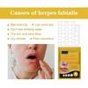Oral Blister Patch, Cold Sore Lip Blister Patch, Cold Sore HealingHydrocolloid Lip Care Patch, 60 Pieces