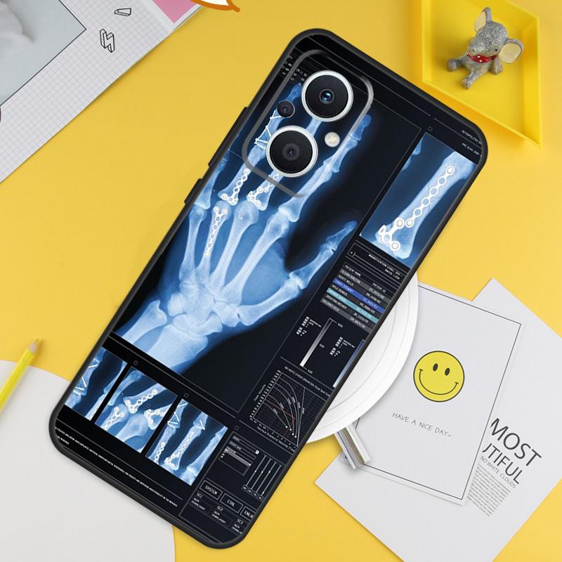 

Radiological Human Organs Skeleton For OPPO Reno 13F 11F 12F 14F 10 11 12 13 14 Pro 8T 7 8 Lite OPPO Find X8 X6 X5 X9 Pro Case OPPO Reno12 F