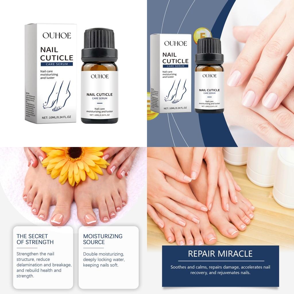 Ouhoe Nourishing Nail Repair Essence For Healthy Strong Clean Nails And Toenails