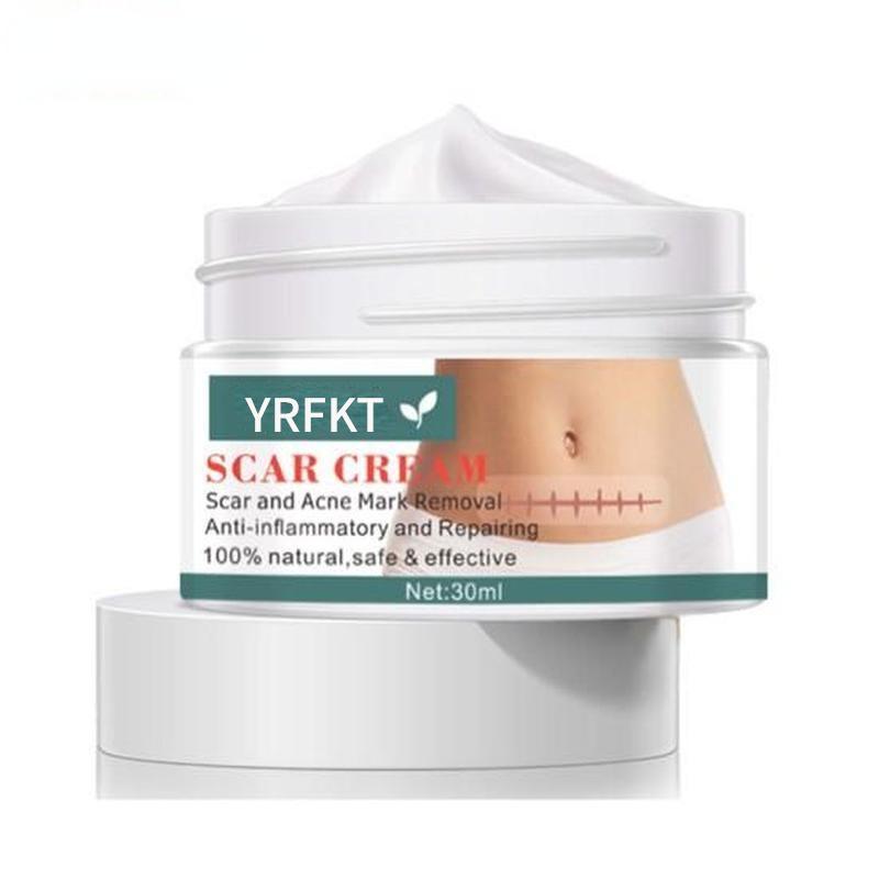 Cremă de întindere pentru cicatrici pentru acnee