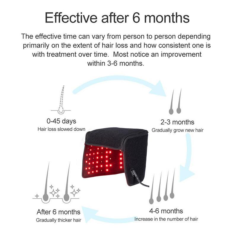 16W Promotes Hair Growth and Anti-Hair Loss Equipment Relieves Migraine Head Massage Device LED Red Light Treatment Cap 39 X 30 X 30 Cm