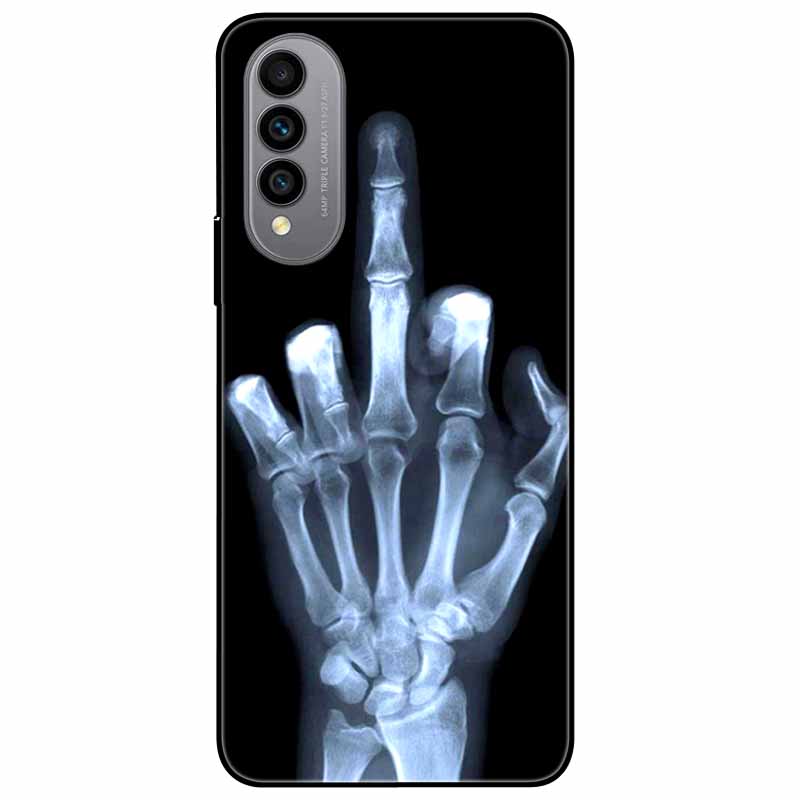 For Wiko T50 Case T 50 Phone Cover Soft Silicone Shockproof TPU Back Cases for Wiko T50 WikoT50 4G 6.6'' Fundas Coques Animal