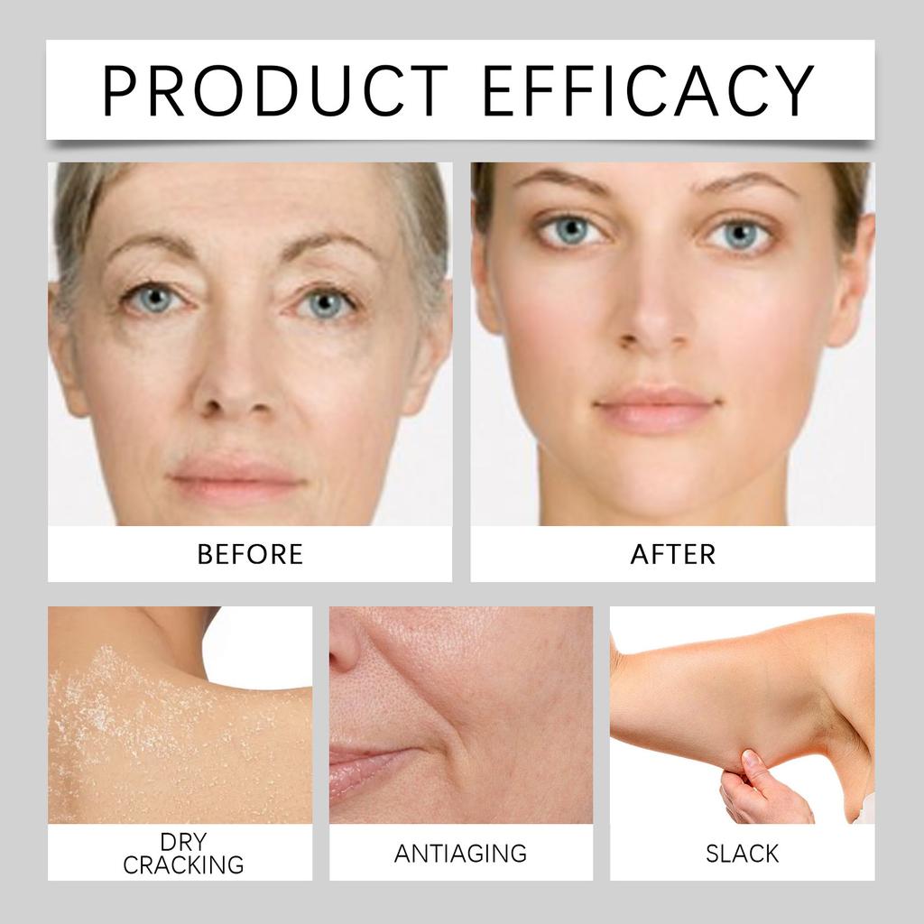 Die Rindertalg-Feuchtigkeitscreme spendet tiefenwirksam Feuchtigkeit und schließt sie ein, reduziert Trockenheit und Empfindlichkeit und bietet eine angenehme Pflege für die Haut.