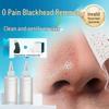BEAUTY NOTES Blackhead Removal Serum Kit