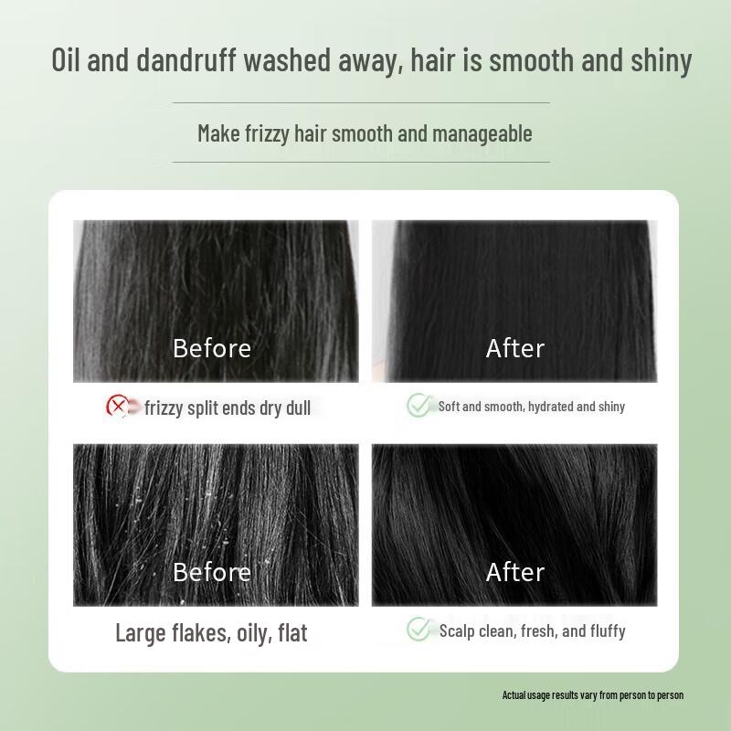 RACLEN Forest Wood Silk Smooth Anti-Dandruff Shampoo