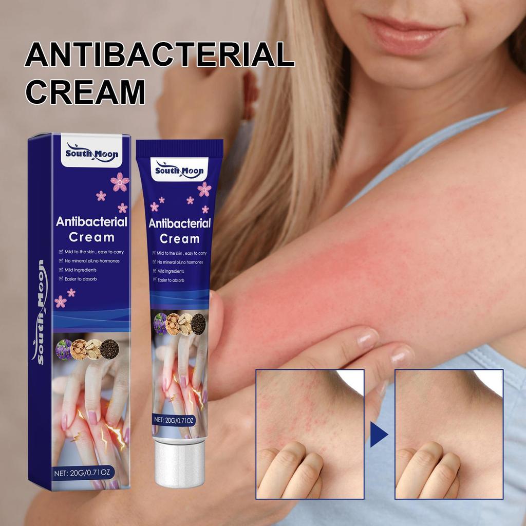20g Zinfandel Skin Itch Relief Cream Dry, Itchy, Reddened Skin Relief Moisturizing Treatment Ointment