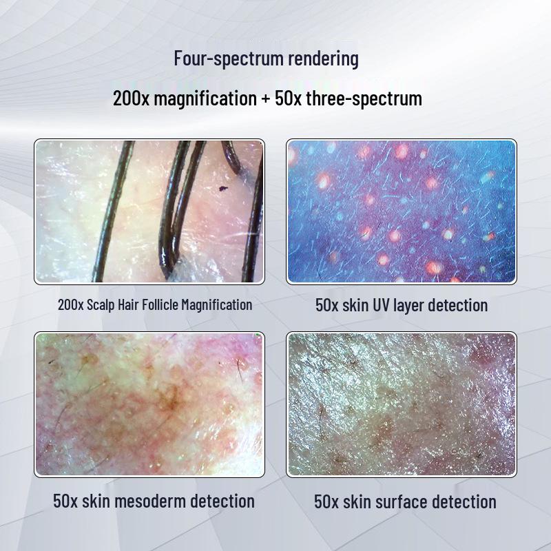 Tri-Spectrum HD Dual-Lens Scalp and Skin Detector with Four-Grid Comparison for Hair Salons