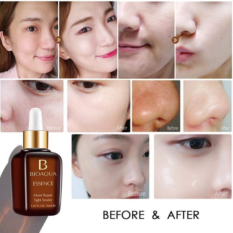 30ml Fruktsyre Ansiktshudserum Krympe porer Essens Fuktighetsgivende Hudpleie Reparasjon Whitening Anti-aldring Skjønnhetsprodukter