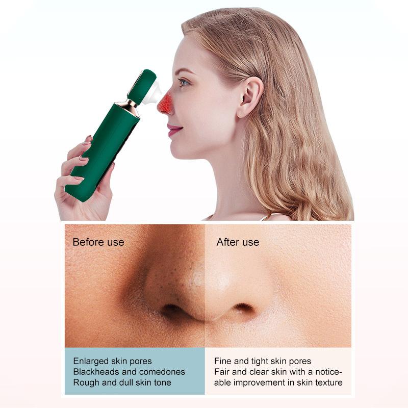 Electric Blackhead Remover USB Rechargeable Facial Blackhead Removal Instrument For Men's And Women's