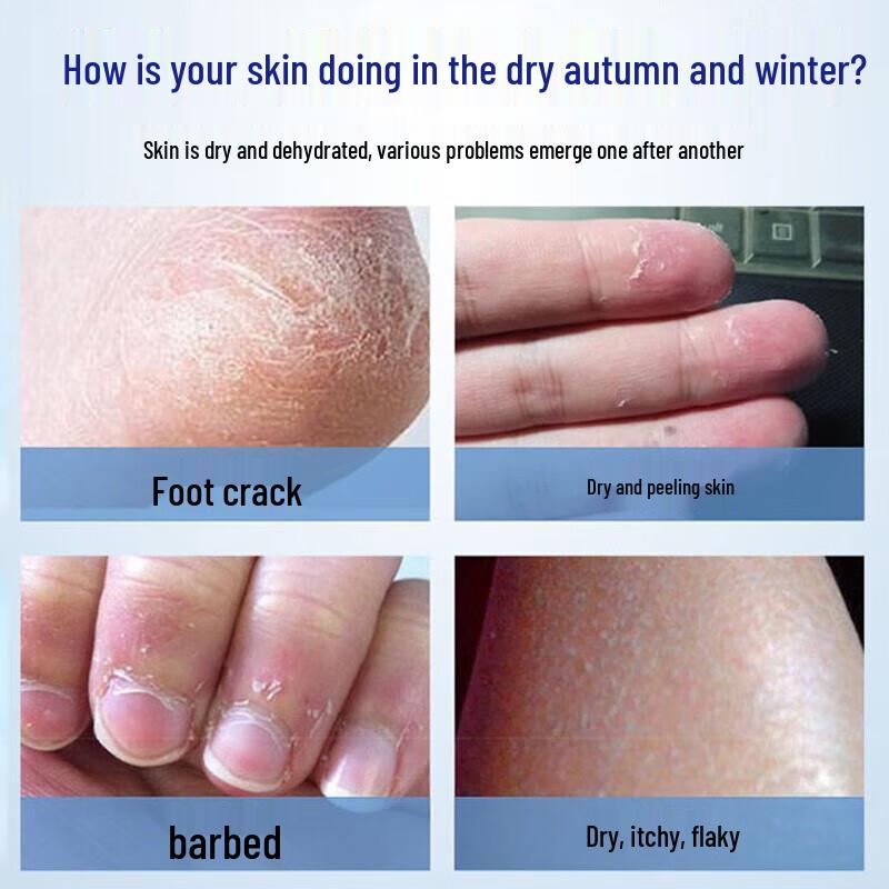 Baicuilai Anti-Rissbildung Fuß- & Handcreme