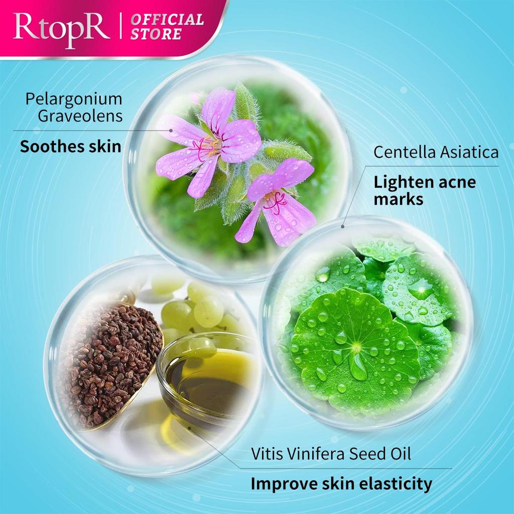 RtopR Acne Removal Cream Skin Repair Face Cream Acne Spots Acne Blackhead Whitening Cream