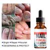 10ml/20ml/30ml Anti Fungus Liquid Toe Finger Nail Infection Repair Treatment