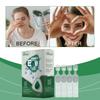 1.5ml*10pcs Eye Care Eye Drops Dry Eye Relief Daily Eye Eye Care Eye Drops