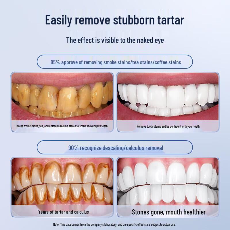 Mibodi Ultrasonic Dental Scaler