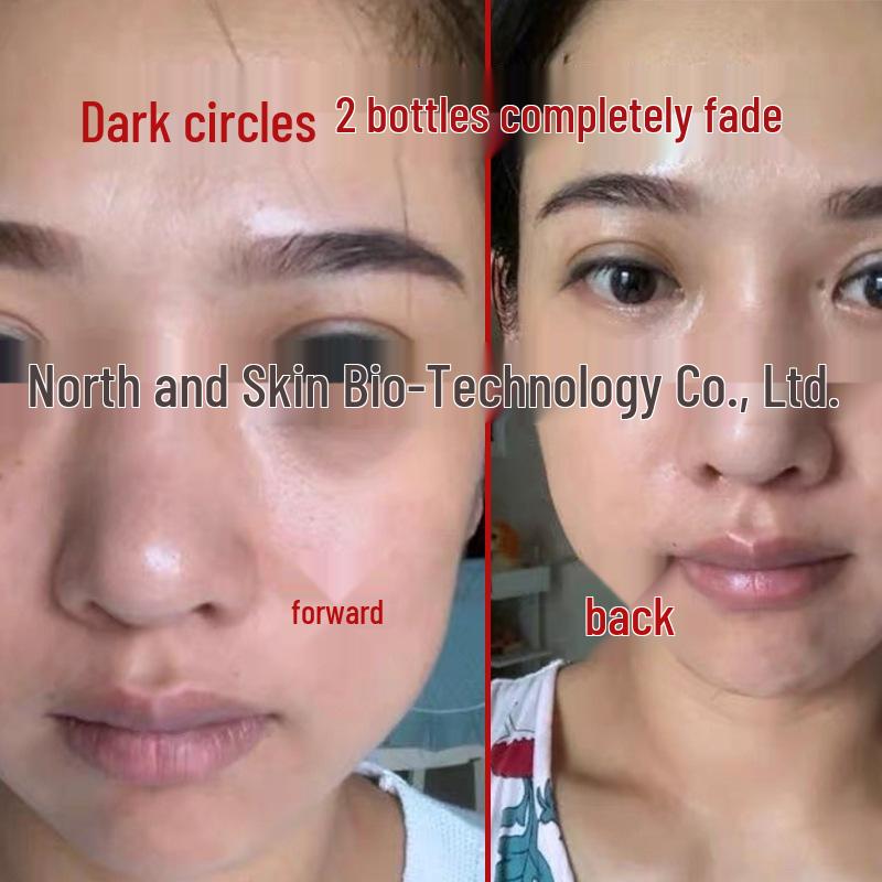 Véritable Crème Fermeté Yeux: Anti-rides, Cernes & Poches, Hydrate & Réduit les Ridules