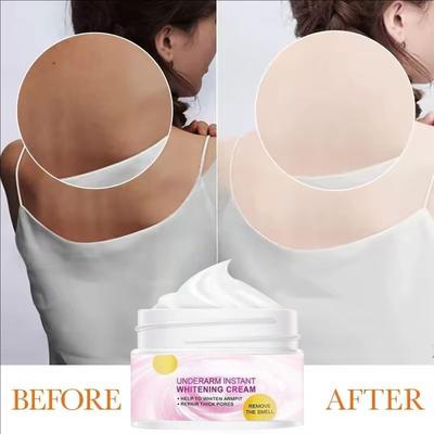 Body Whitening Cream Onderarm Whitening Cream Geslachtsdelen Been Hydraterende witte huid